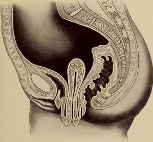 Public Domain. https://commons.wikimedia.org/wiki/File:The_diagnosis_of_diseases_of_women_(1905)_(14576847547).jpg